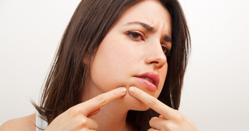 YOUR SKIN CARE GUIDE: ACNE AND BREAKOUTS AS AN ADULT